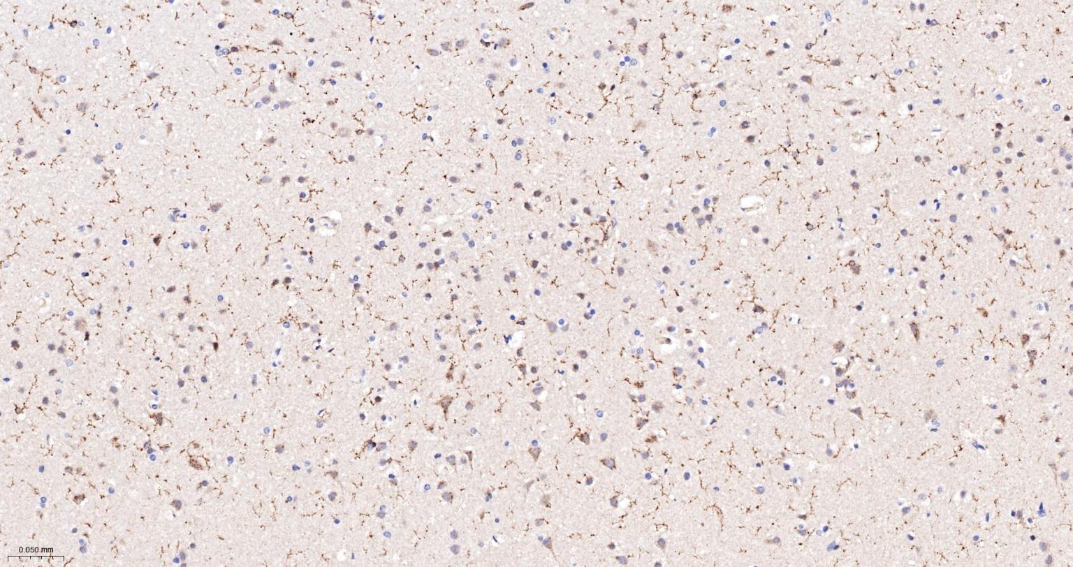 Rat anti-PTEN Monoclonal Antibody