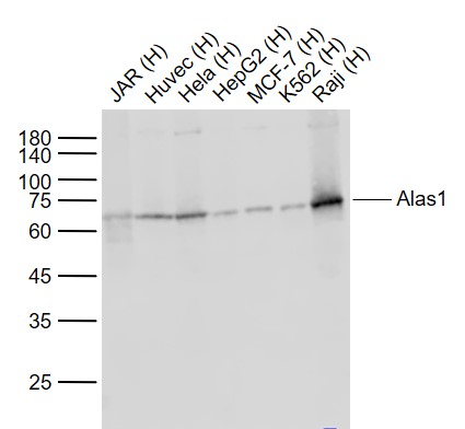 Rabbit anti-Alas1 (1G11) Monoclonal Antibody