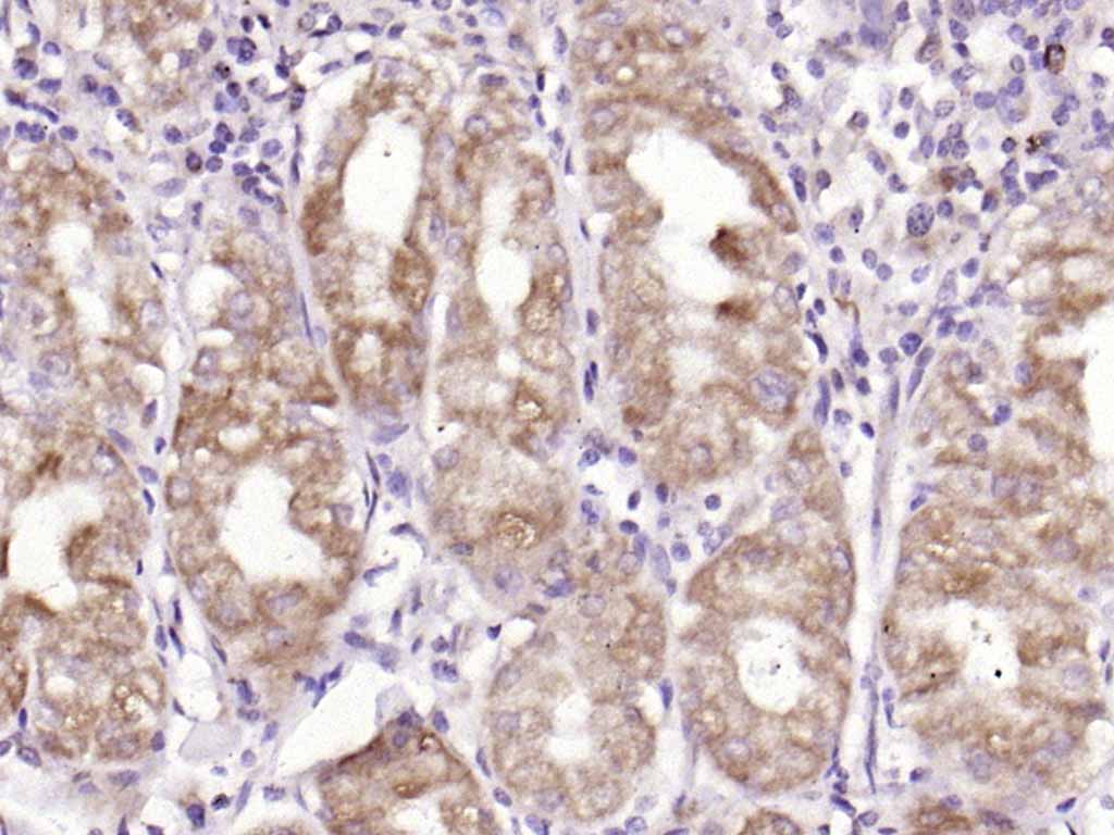 Rabbit anti-ADAM28 Polyclonal Antibody