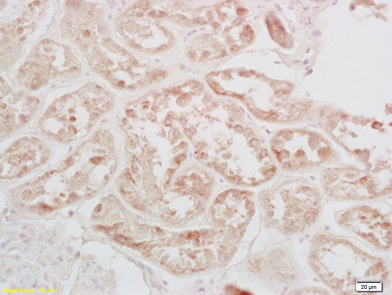Rabbit anti-Phospho-CREB-1(Ser133) Polyclonal Antibody