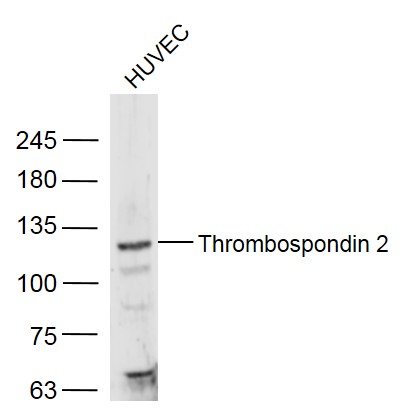 Rabbit anti-Thrombospondin 2 Polyclonal Antibody