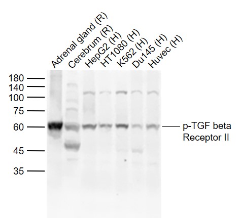 Rabbit anti-Phospho-TGF β Receptor II(Ser225) Polyclonal Antibody