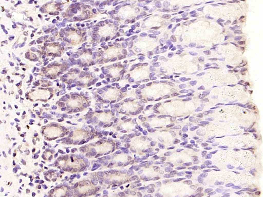 Rabbit anti-MADH7 Polyclonal Antibody