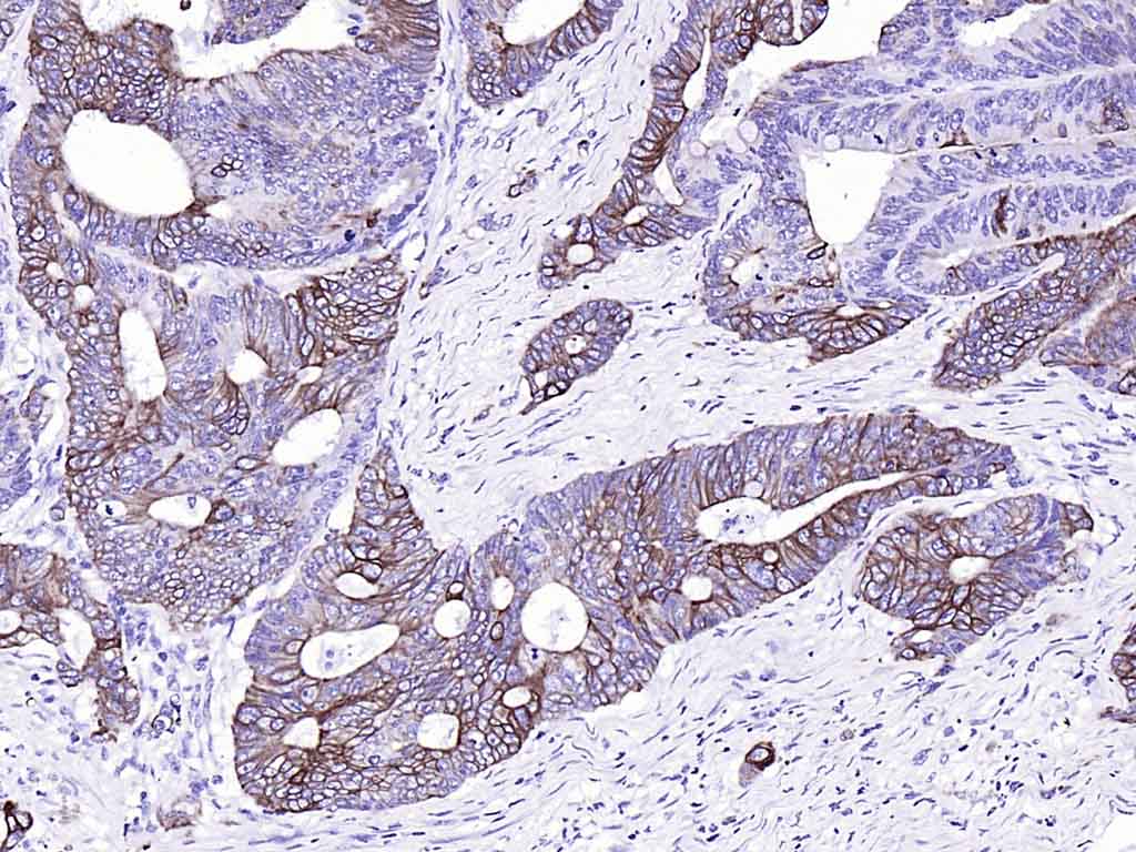 Rabbit anti-CK20 Monoclonal Antibody