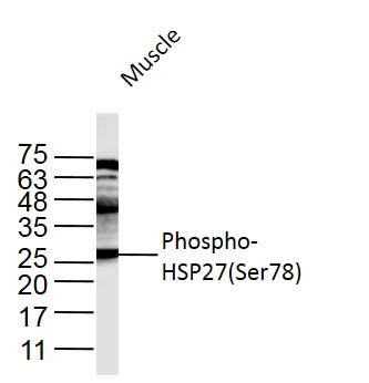 Rabbit anti-Phospho-HSP27(Ser78) Polyclonal Antibody