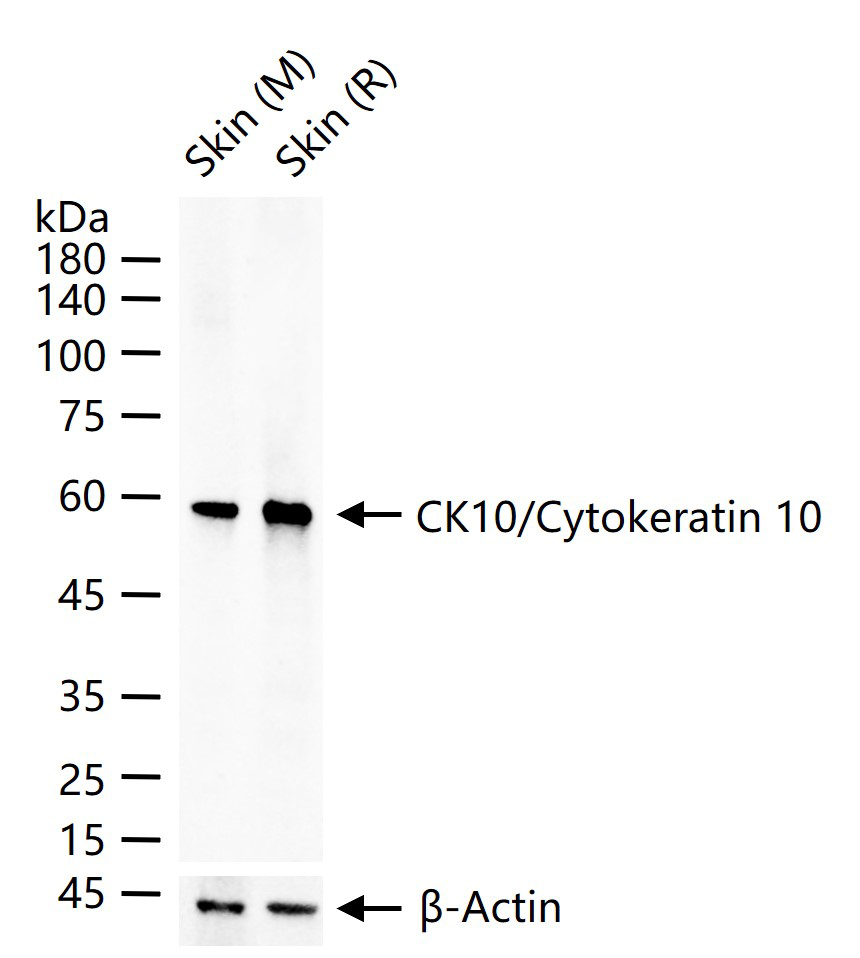 Rabbit anti-CK10/Cytokeratin 10 Monoclonal Antibody