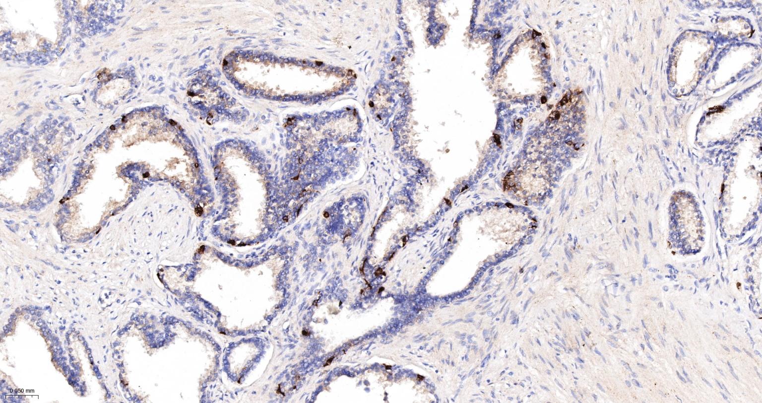 Rat anti-PTEN Monoclonal Antibody