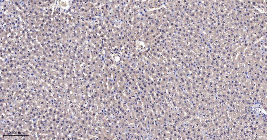 Rabbit anti-TSG101 Monoclonal Antibody