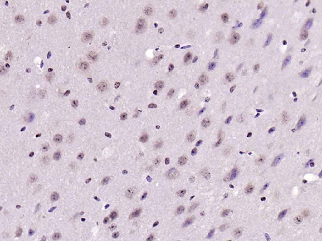 Rabbit anti-Phospho-IRS1(Ser636+Ser639) Polyclonal Antibody