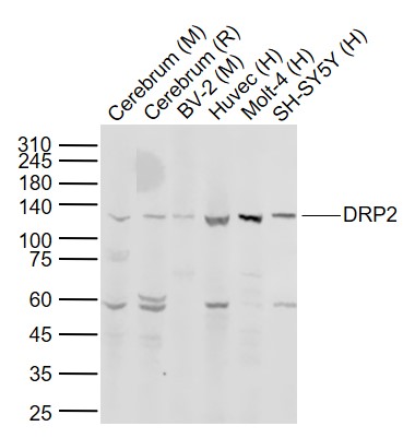 Rabbit anti-DRP2 Polyclonal Antibody