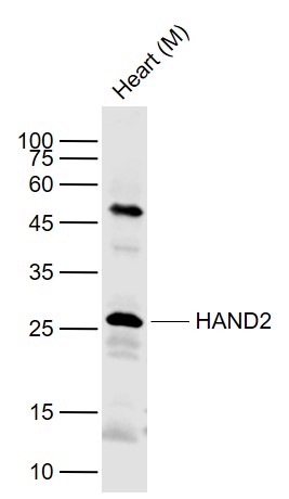 Rabbit anti-HAND2 Polyclonal Antibody