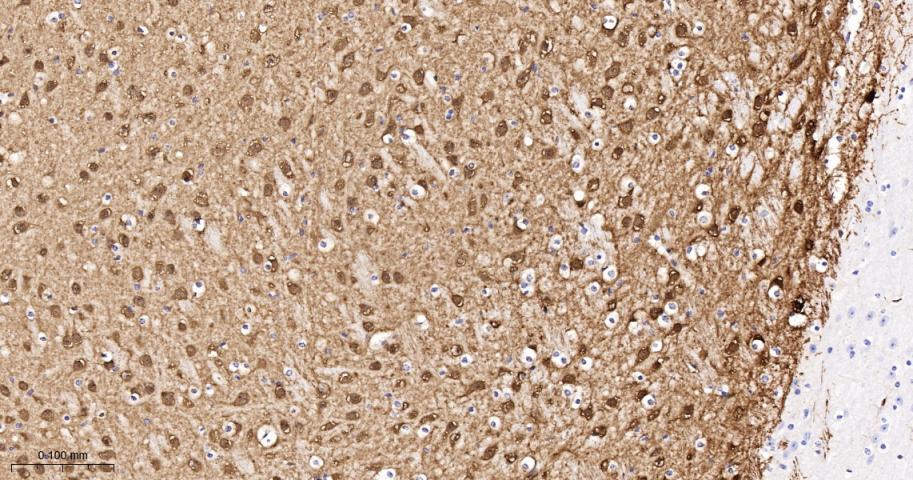 Rabbit anti-PKC δ Monoclonal Antibody