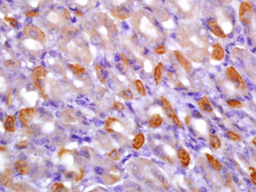 Rabbit anti-Phospho-CaMK2α(Tyr230) Polyclonal Antibody