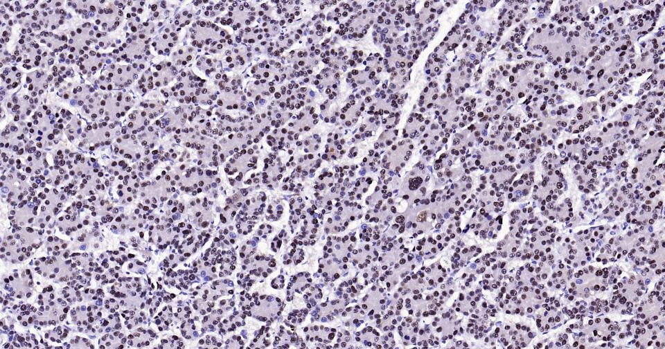 Rabbit anti-PCNA(Nuclear Loading Control) Monoclonal Antibody