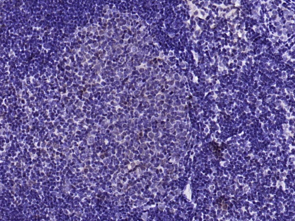 Rabbit anti-Phospho-YB1(Ser102) Polyclonal Antibody