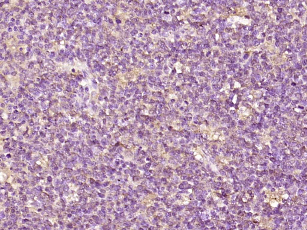 Rabbit anti-EDC4 Polyclonal Antibody