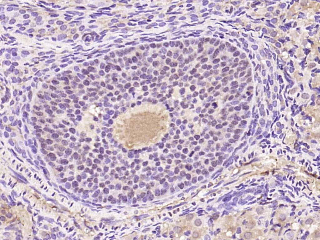 Rabbit anti-Phospho-PKC δ(Tyr52) Polyclonal Antibody