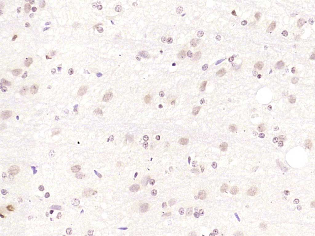 Rabbit anti-TOB Polyclonal Antibody