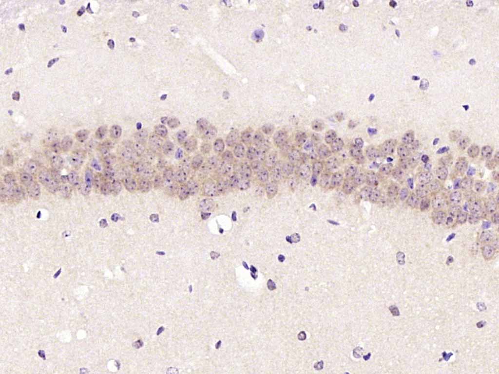 Rabbit anti-Phospho-PKC δ(Ser645) Polyclonal Antibody
