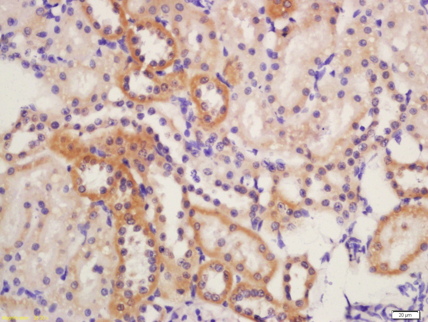Rabbit anti-ALDH1L1 Polyclonal Antibody
