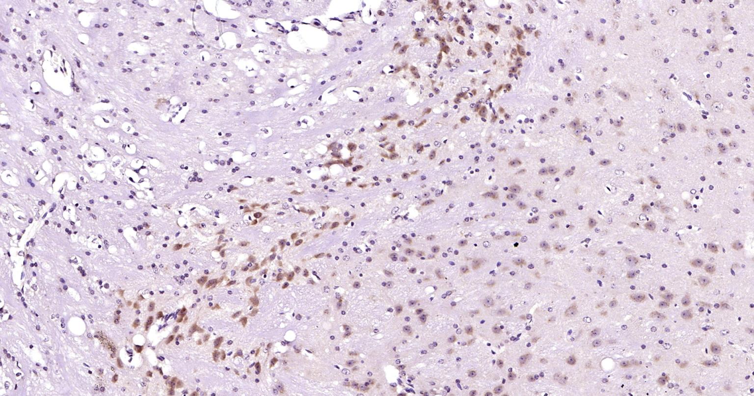 Rabbit anti-Beclin 1 Polyclonal Antibody