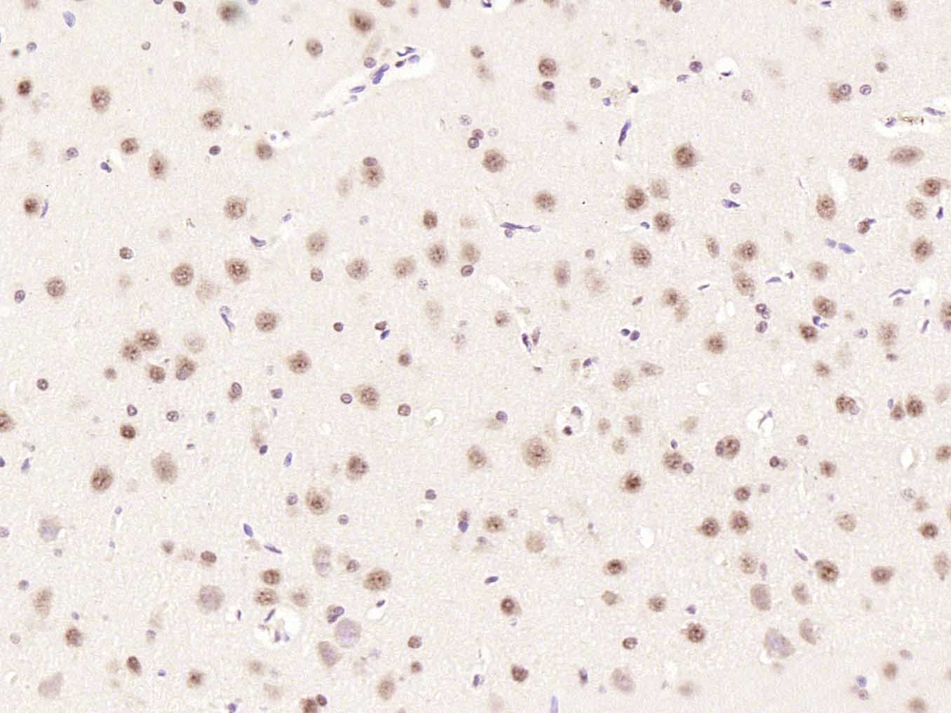 Rabbit anti-Phospho-mTOR(Ser2448) Polyclonal Antibody