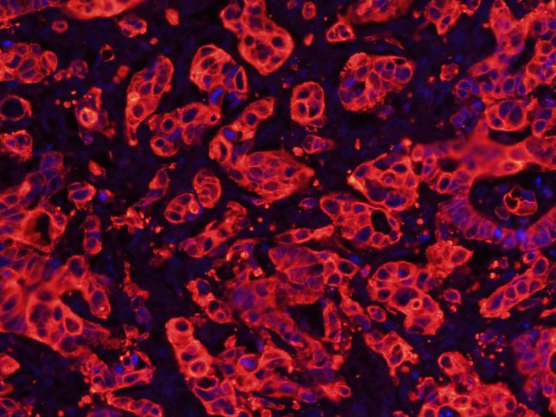 Mouse anti-Cytokeratin 8 Monoclonal Antibody