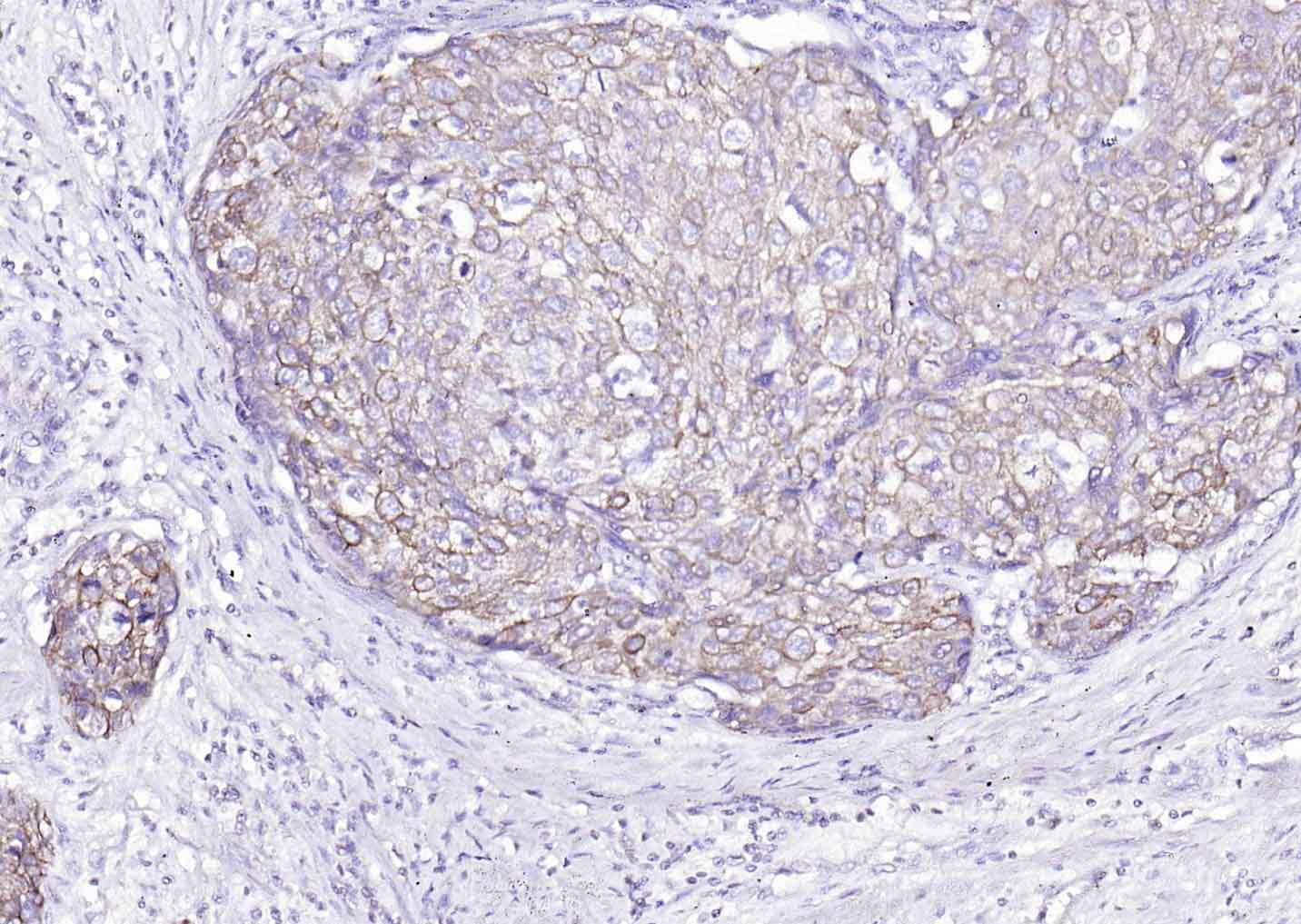 Mouse anti-Cytokeratin 8 Monoclonal Antibody