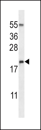 Rabbit Anti-ECP Polyclonal Antibody