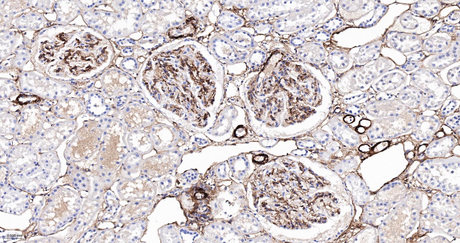 Rabbit anti-CD105 Polyclonal Antibody