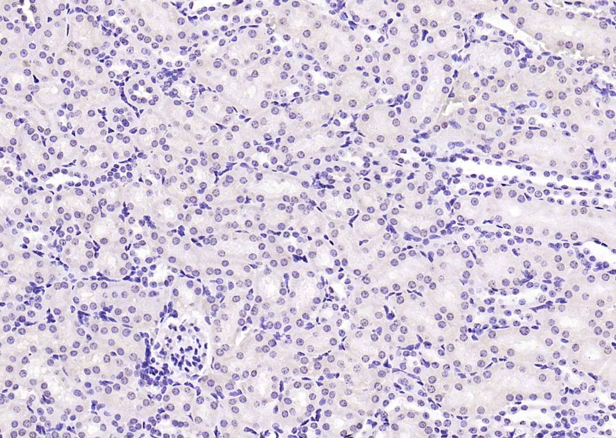 Rabbit anti-Phospho-PI3 Kinase p110 β(Ser1070) Polyclonal Antibody
