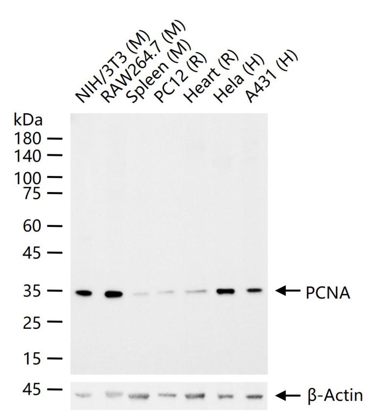 Rabbit anti-PCNA(Nuclear Loading Control) Monoclonal Antibody