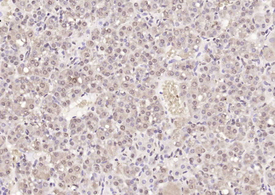 Rabbit anti-Phospho-IKBα(Tyr305) Polyclonal Antibody