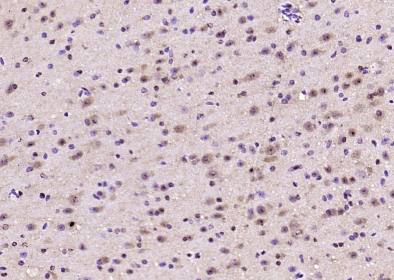 Rabbit anti-Phospho-FAK(Ser722) Polyclonal Antibody