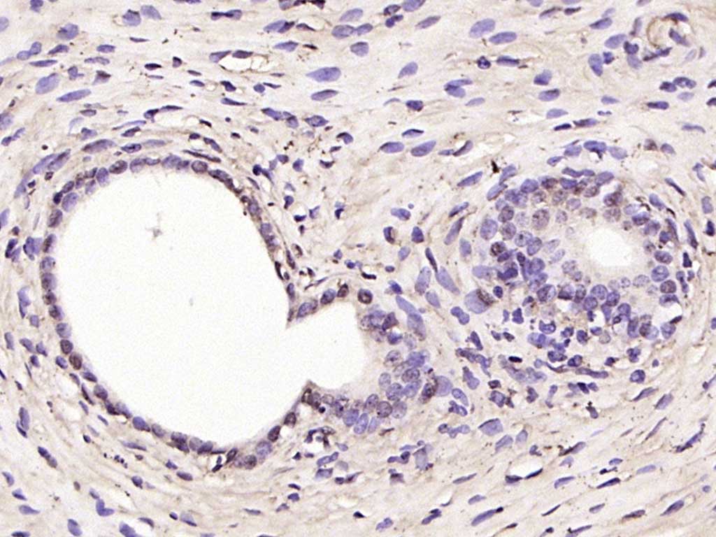 Rabbit anti-RSL1D1 Polyclonal Antibody