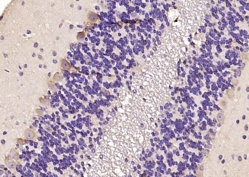 Rabbit Anti-MARCH6 Polyclonal Antibody