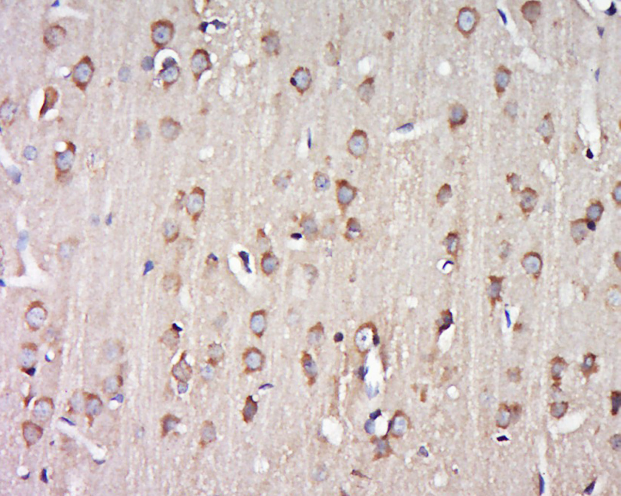 Rabbit anti-G Protein α16 Polyclonal Antibody