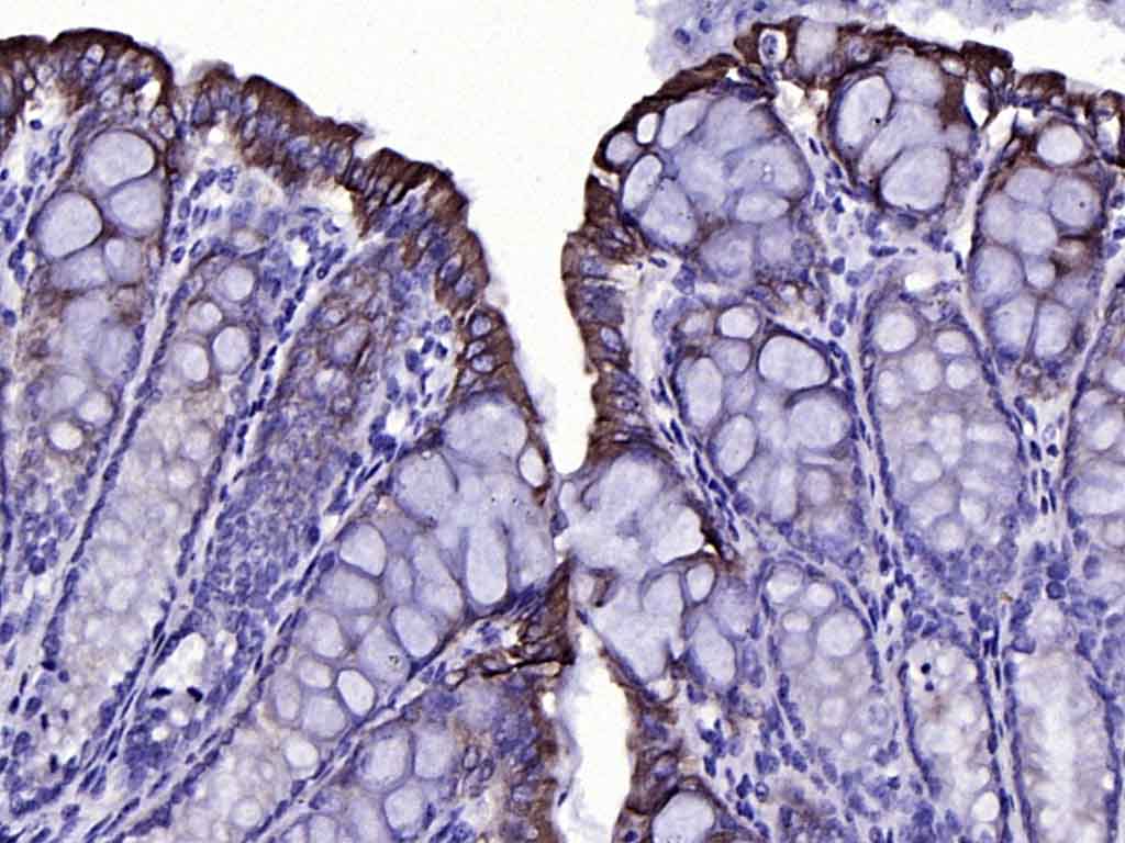 Mouse anti-Cytokeratin 19 Monoclonal Antibody