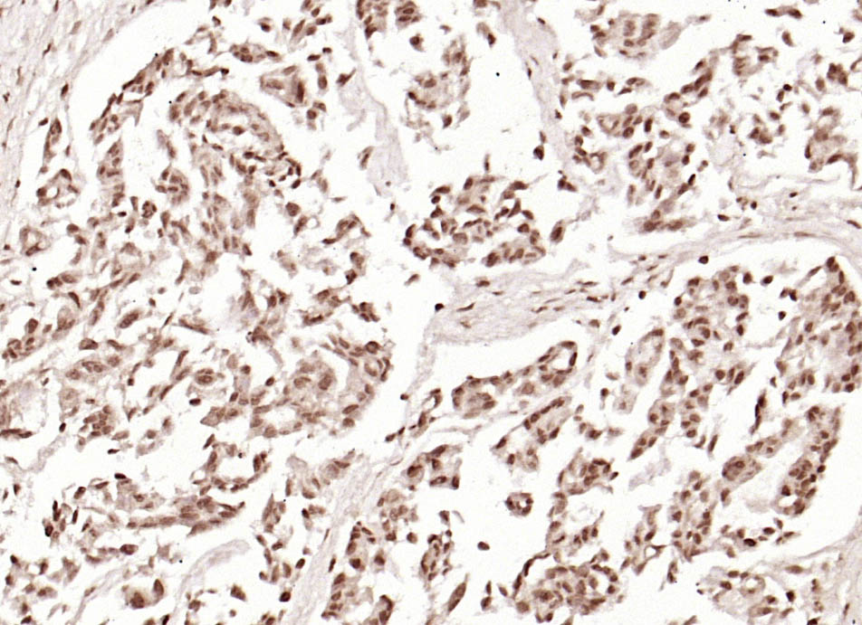 Rabbit anti-Phospho-β Catenin(Thr41+Ser45) Polyclonal Antibody