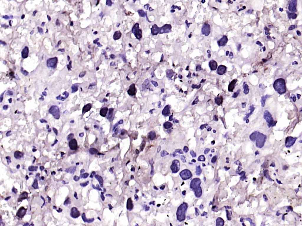 Rabbit anti-MYCL Polyclonal Antibody