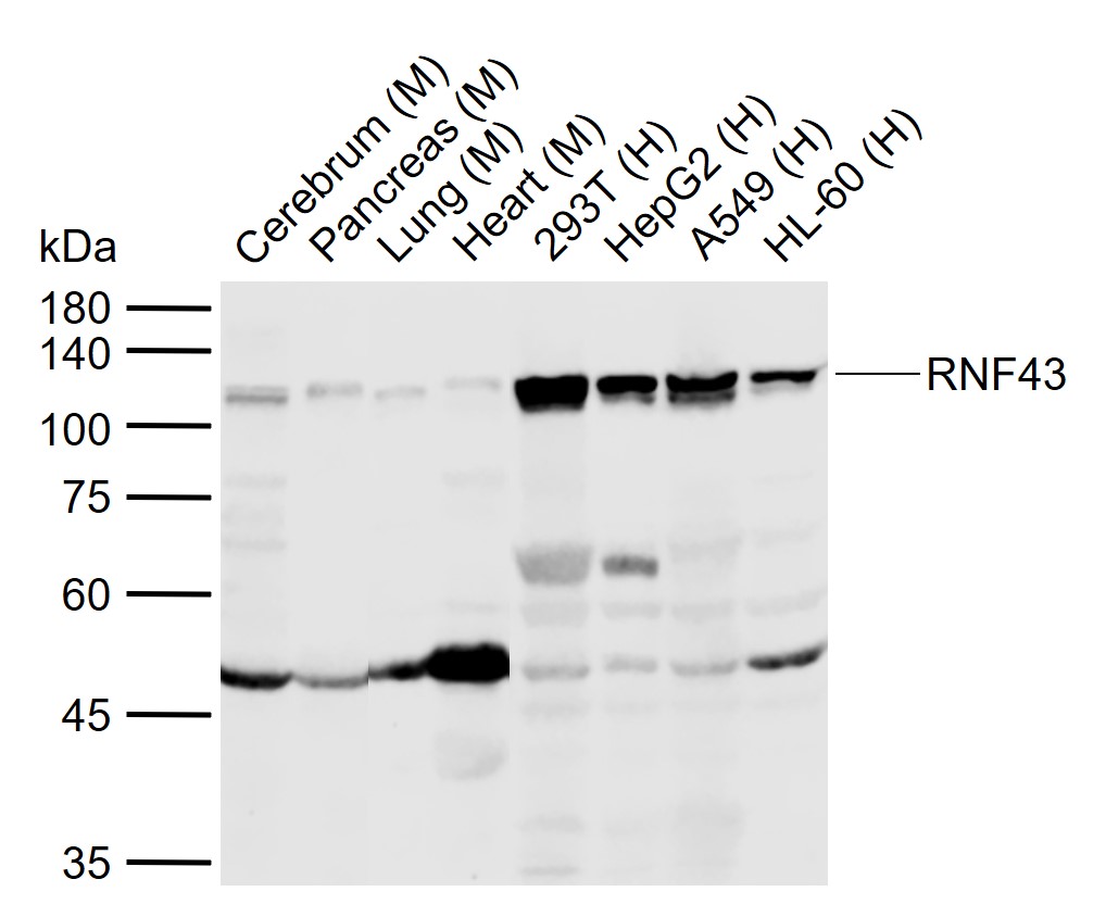 Rabbit anti-RNF43 Polyclonal Antibody