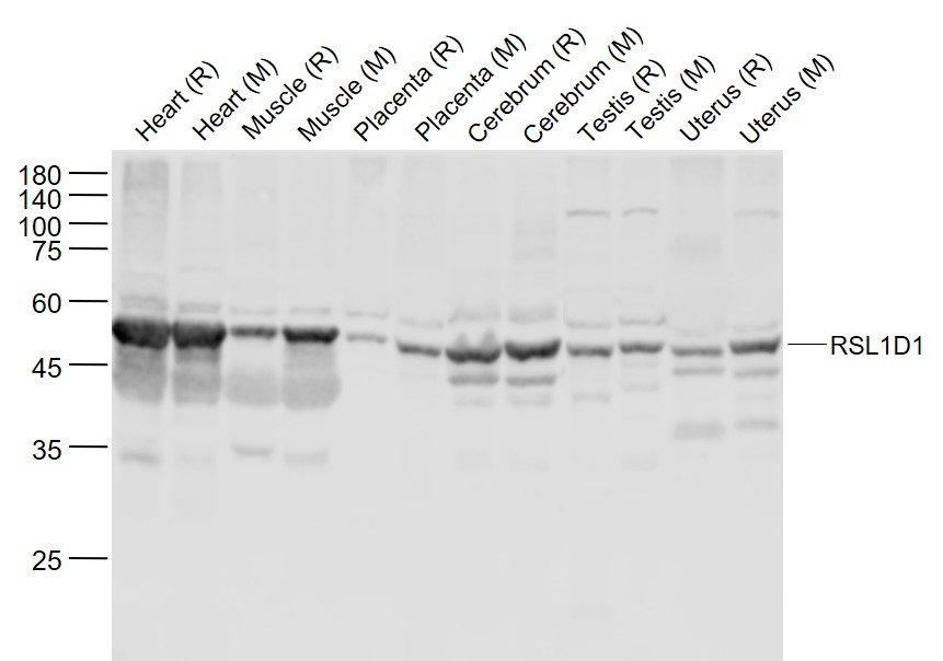 Rabbit anti-RSL1D1 Polyclonal Antibody