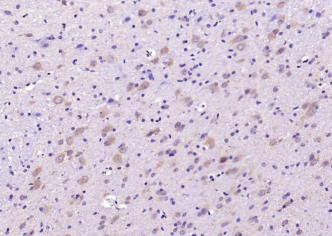 Rabbit anti-SOD2 Polyclonal Antibody