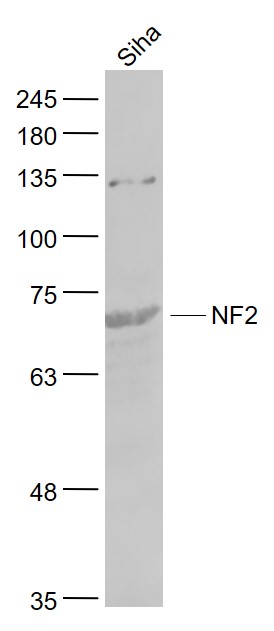 Rabbit anti-NF2 Polyclonal Antibody
