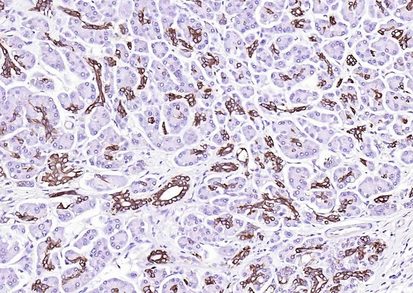 Mouse anti-Cytokeratin 19 Monoclonal Antibody