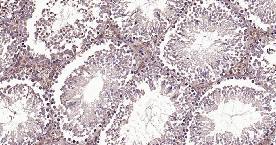 Rabbit anti-β-Tubulin Polyclonal Antibody