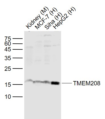 Rabbit anti-TMEM208 Polyclonal Antibody