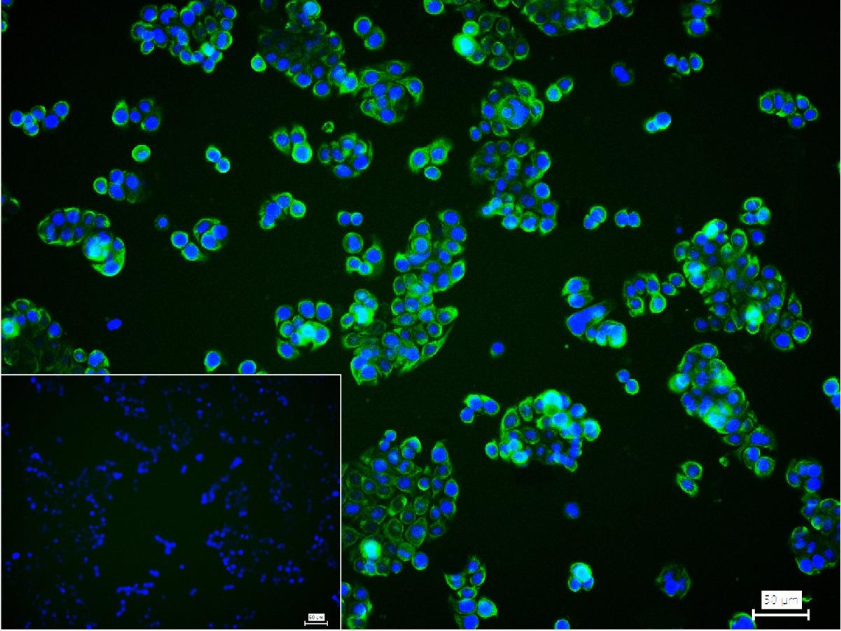 Rabbit anti-CK20 Monoclonal Antibody