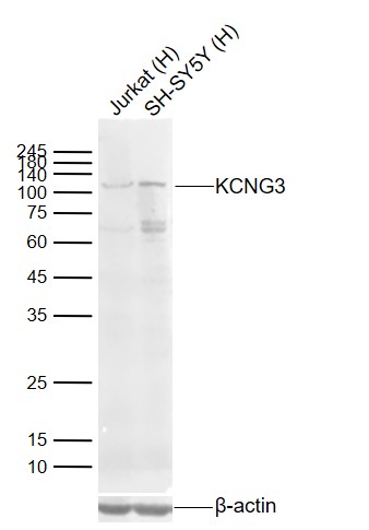 Rabbit Anti-KCNG3 Polyclonal Antibody