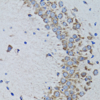Rabbit anti-PTPN1 Polyclonal Antibody